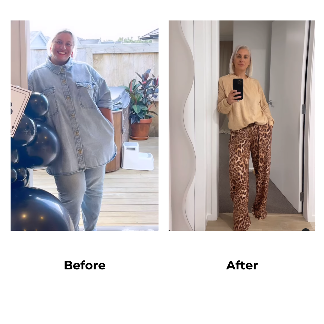 Luna lost 43 kg after gastric sleeve surgery in Thailand